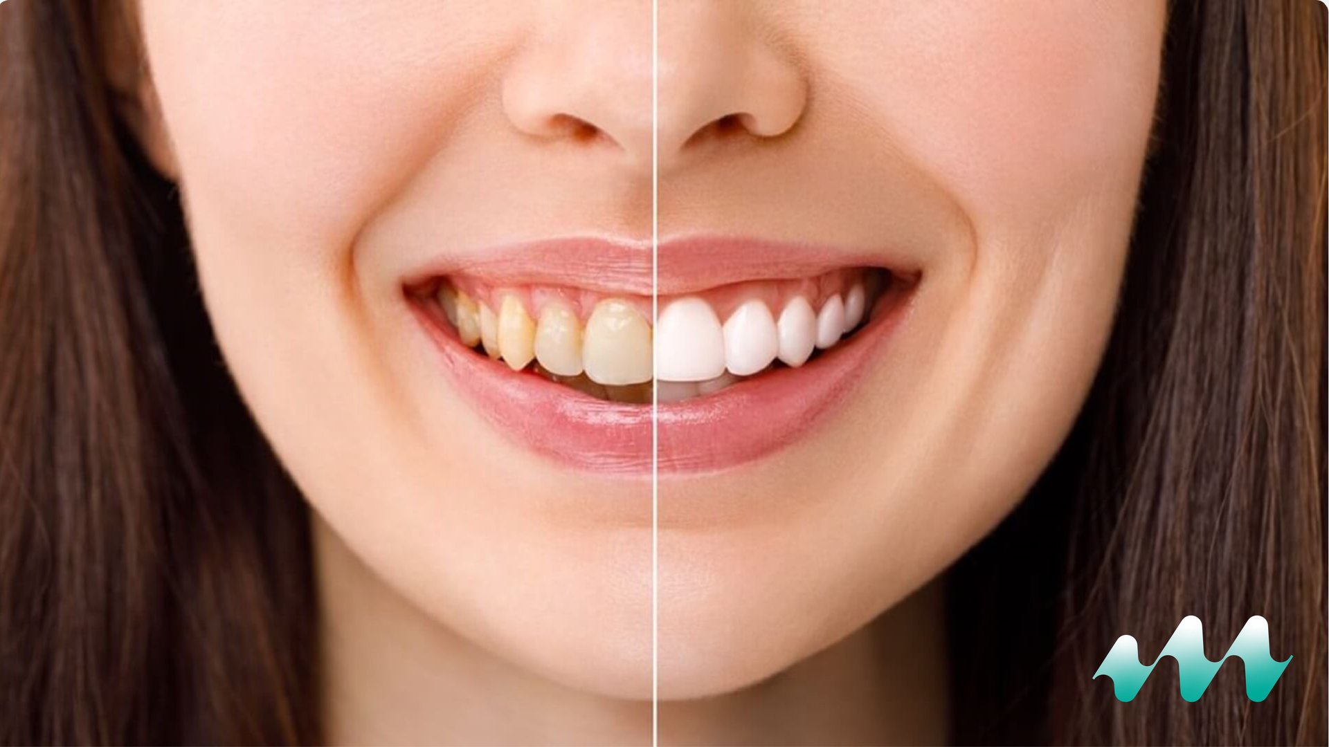 General dental care visual for check-ups and preventive treatment at Medicape Health