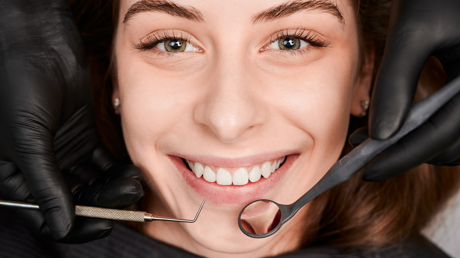 Patient with natural-looking zirconium crowns during a dental check-up in Turkey