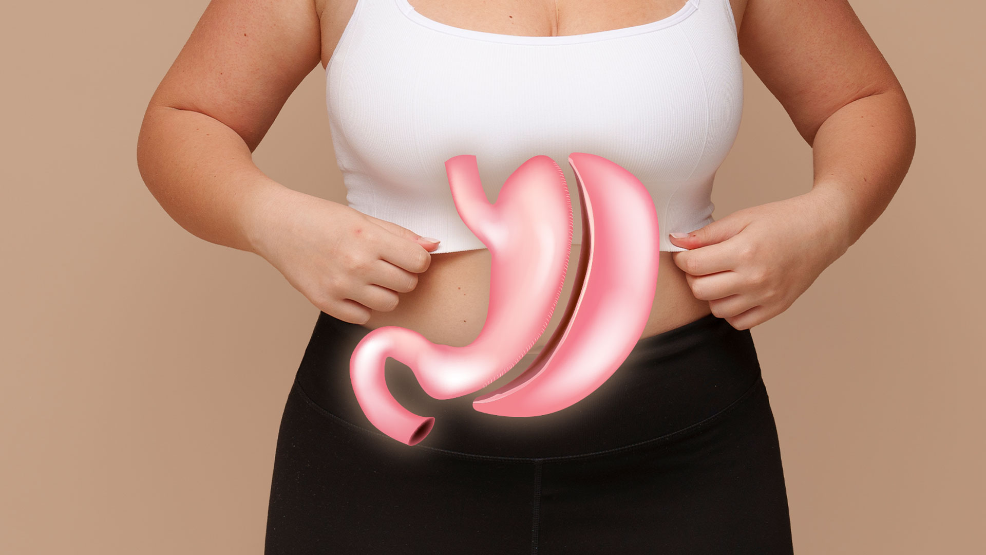 Gastic Sleeve Surgery