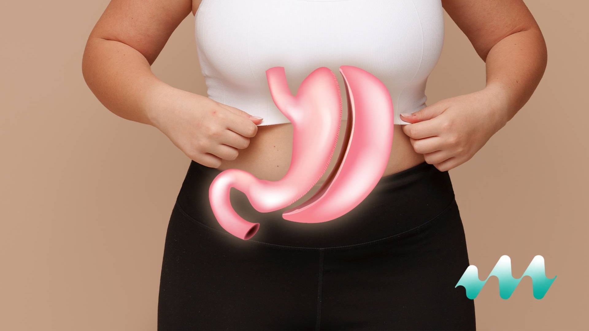Gastic Sleeve Surgery