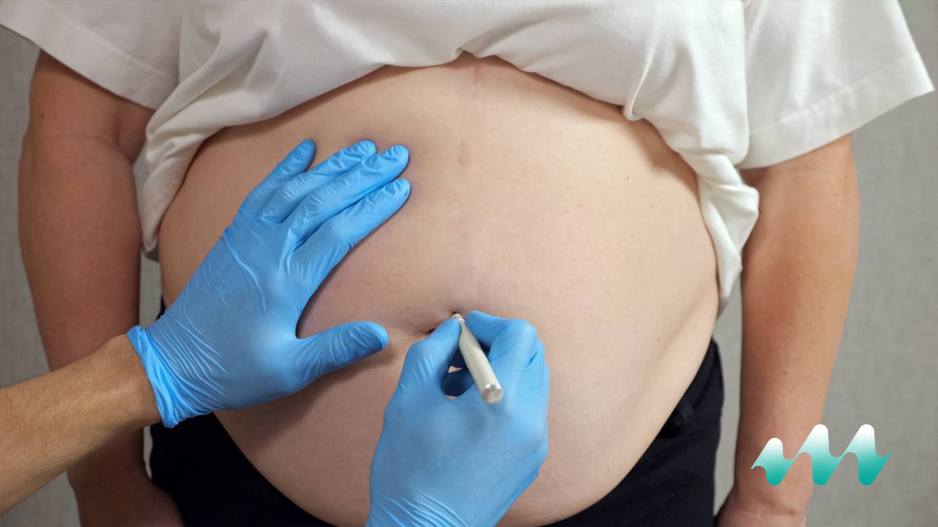 Obesity Treatments