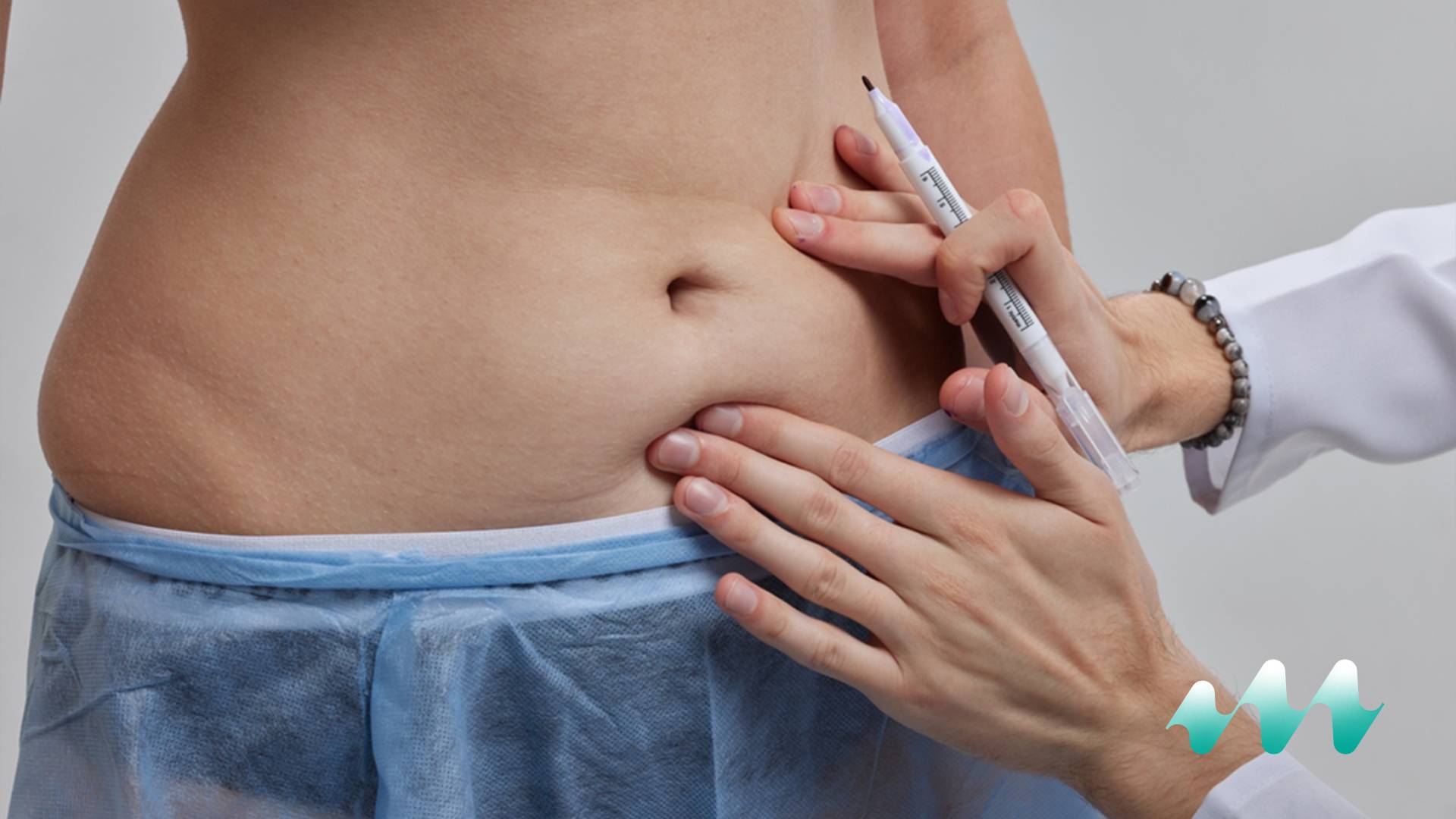 Post Bariatric Surgery
