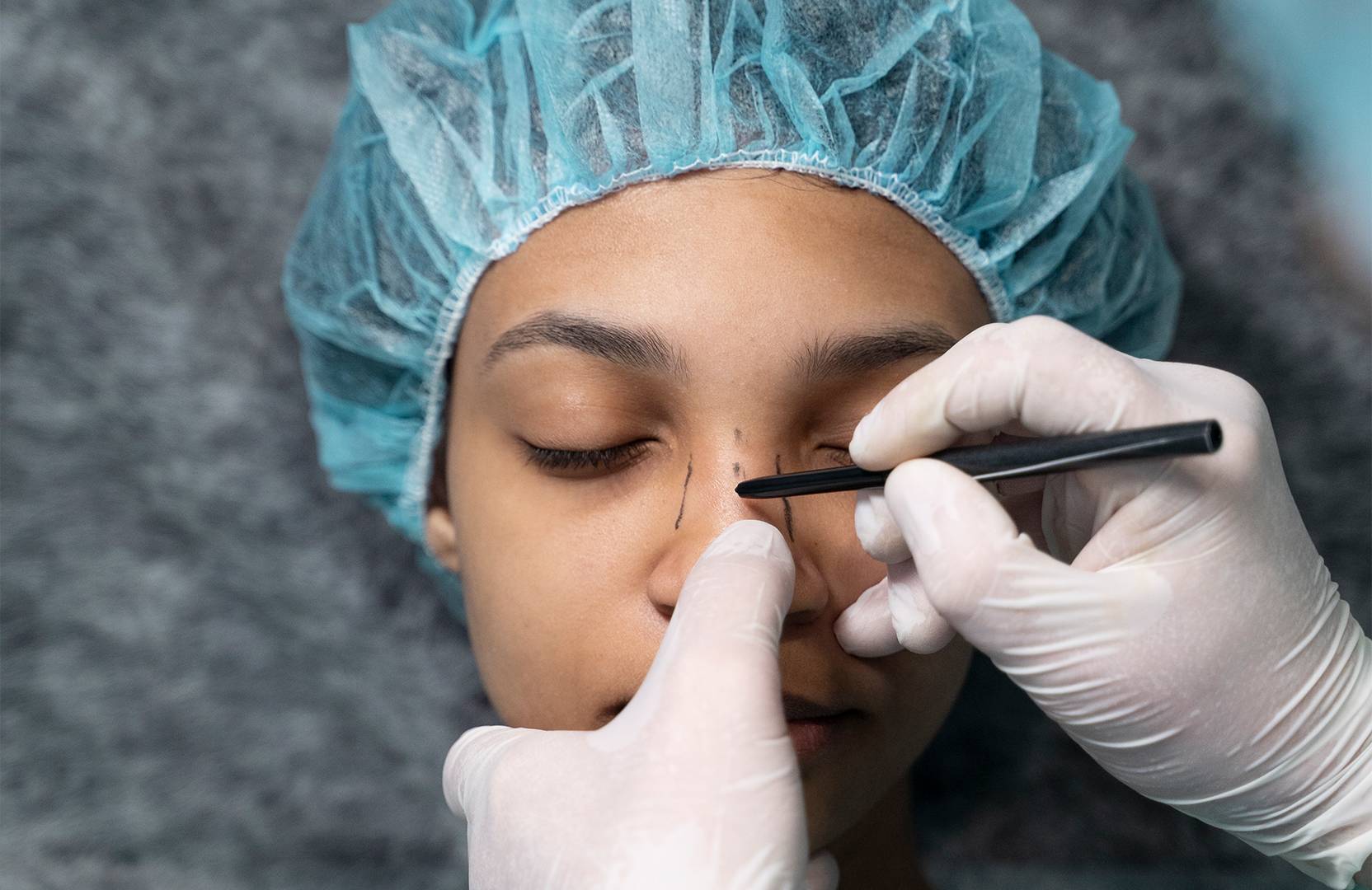 Nose Plastic Surgery
