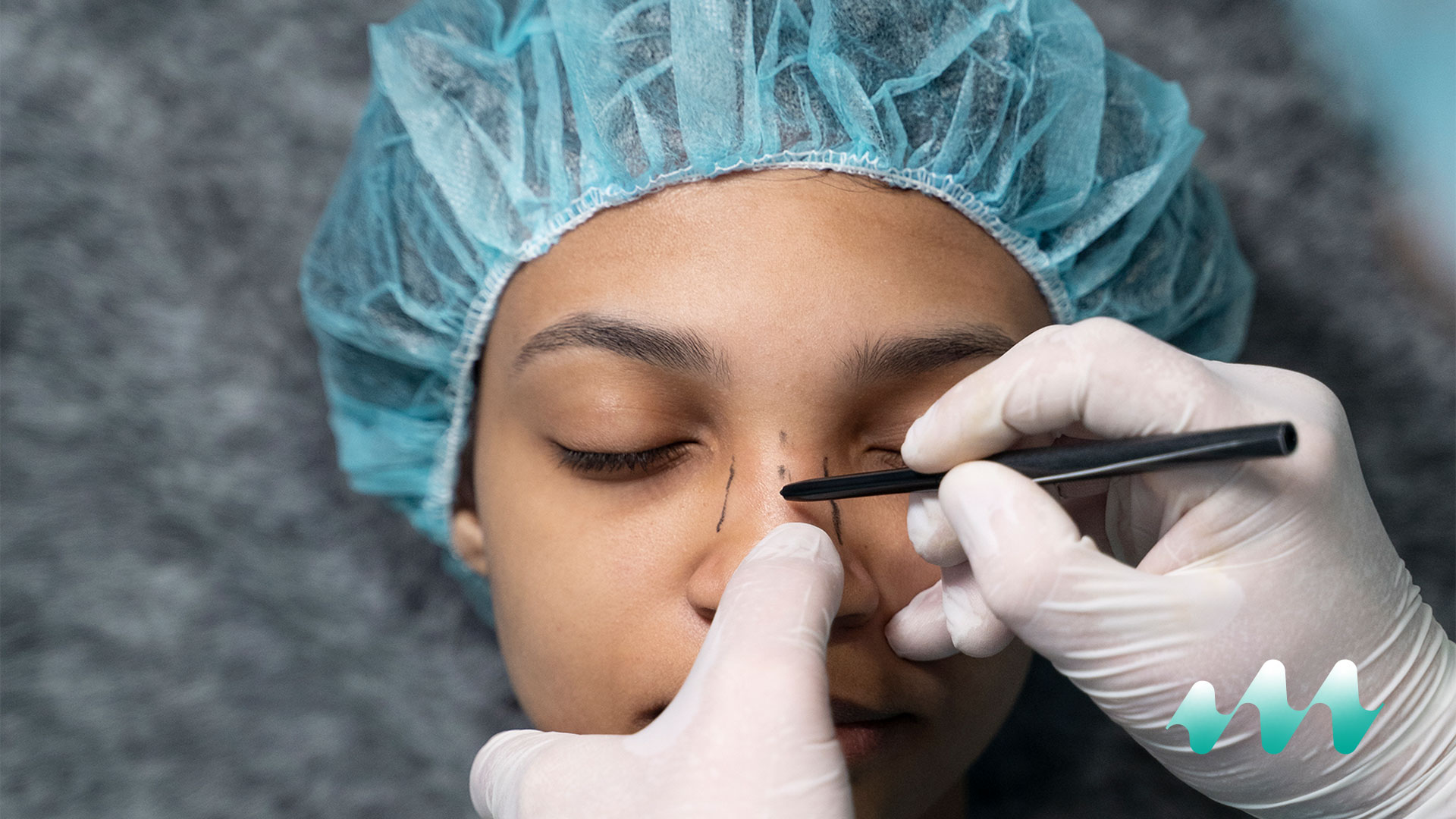 Revision Rhinoplasty